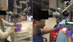 (A) Experimental setup for freehand microvascular anastomosis trials; (B) experimental setup for Robotic ENT Microsurgical System-assisted microvascular anastomosis trials. © The American Laryngological, Rhinological and Otological Society, Inc.