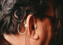 Does Cochlear Implantation Improve Cognitive Function?