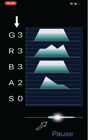 Fig. 1. iPhone application named “GRBASZero.” White arrow: Displayed five voice evaluations in real-time. Black arrow: Tap on the waveform for checking the assessments.