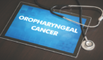 Oropharyngeal Cancer