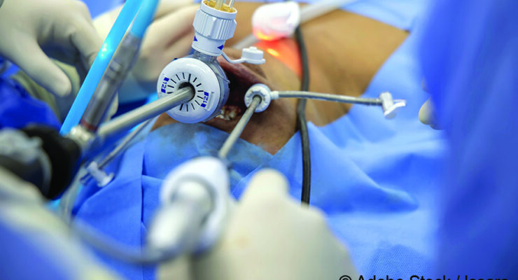 Less Is More: Advancements in Thyroid Surgery